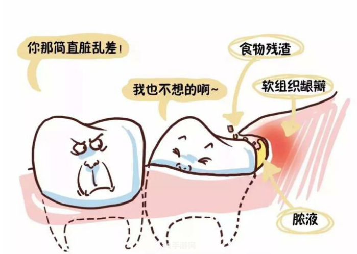 智齿来袭：智齿一定要拔吗？解读智齿的奥秘