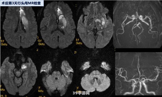 探寻颈动脉窦位置 手游中的医疗知识挑战攻略